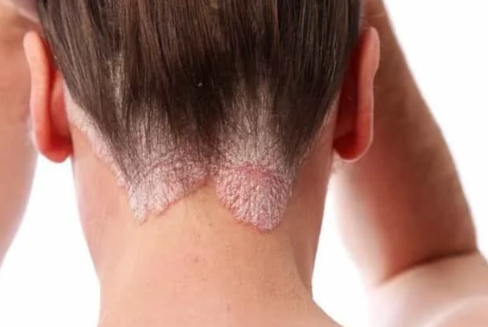 Common Skin Issues and Solutions in Calgary
